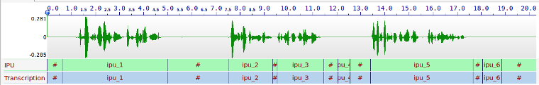 Result of IPUs Segmentation: silence detection
